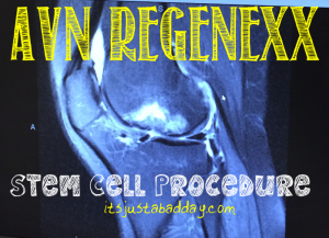 Avascular Necrosis Regenexx Stem Cell Procedure - It's Just A Bad Day